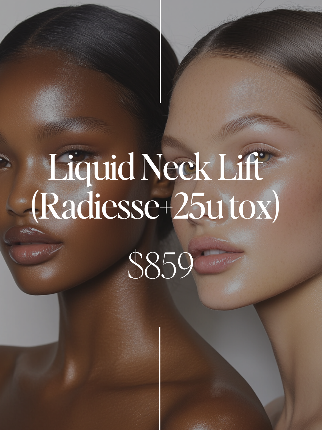 Liquid Neck Lift – Radiesse + Tox Combo