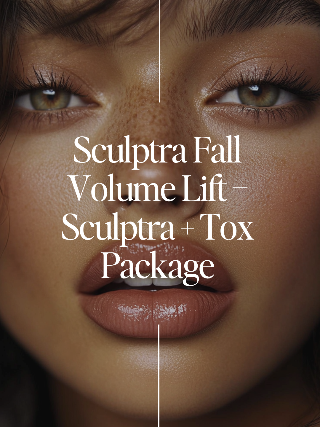 Sculptra Fall Volume Lift – Sculptra + Tox Package